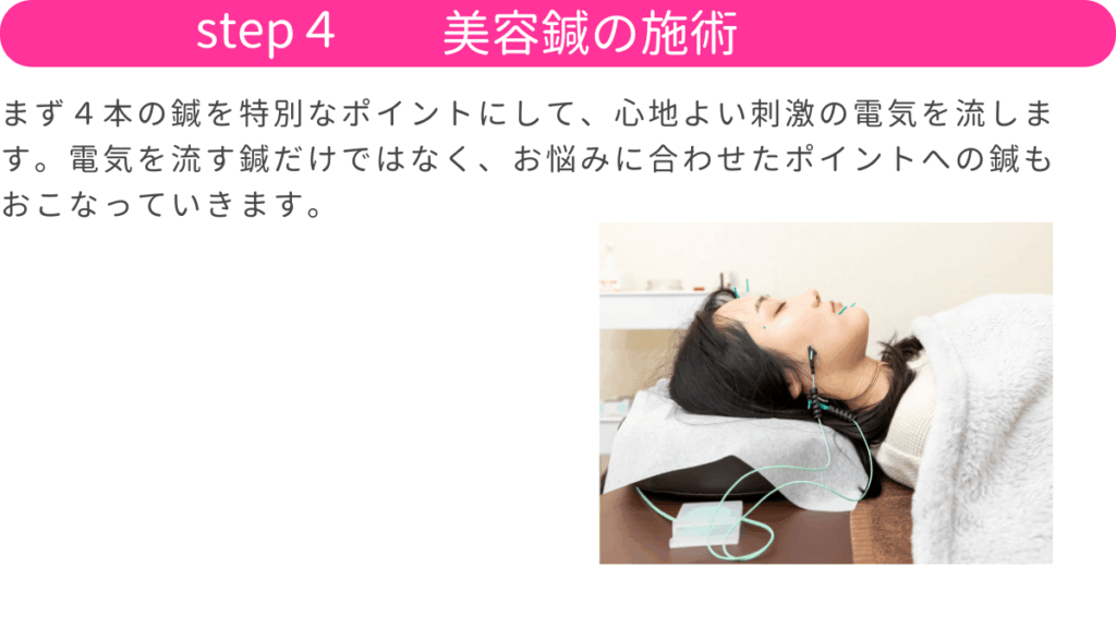 福岡市中央区警固にある鍼灸整体HARISUL警固院の美容鍼灸のSTEP4