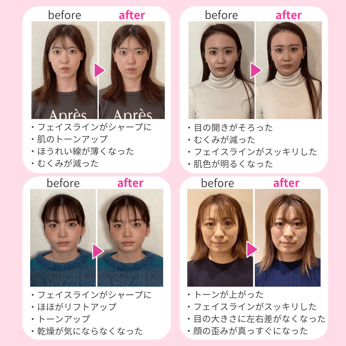 ビフォーアフター例