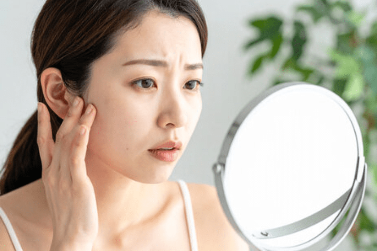 肌の悩みを抱える女性