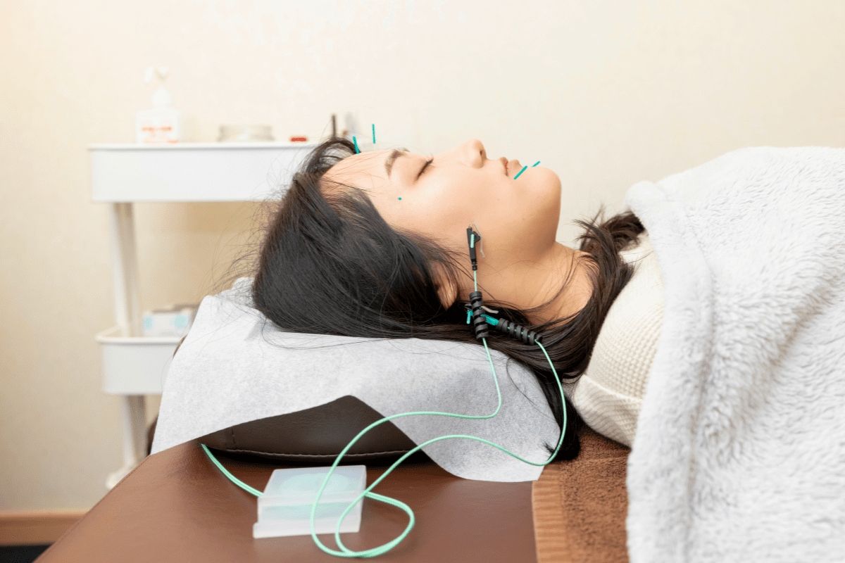 電気を流す美容鍼